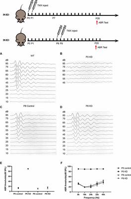 F-Actin Dysplasia Involved in Organ of Corti Deformity in Gjb2 Knockdown Mouse Model